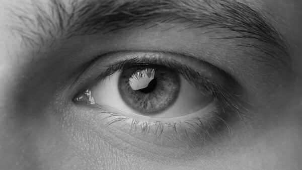 Nystagmus