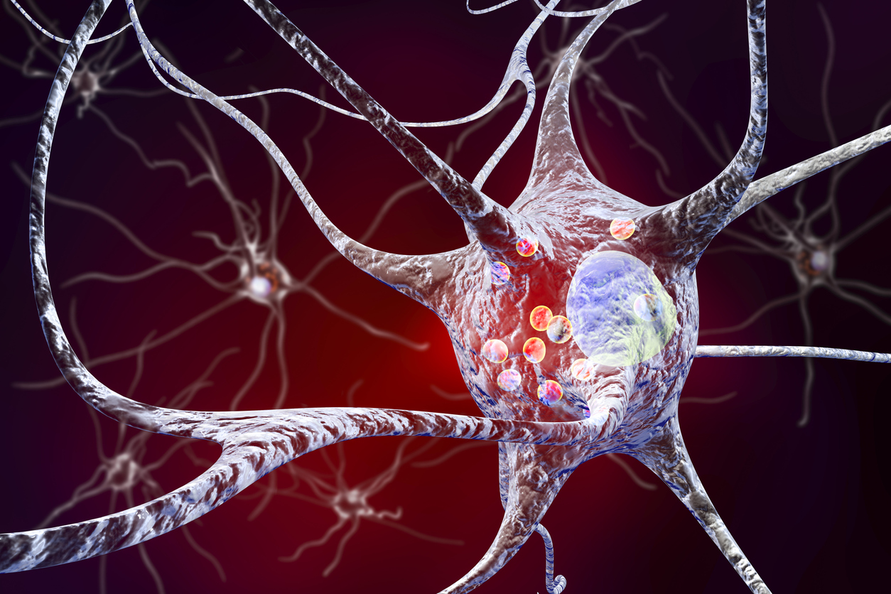 Herseneiwit overactief in de ziekte van Parkinson