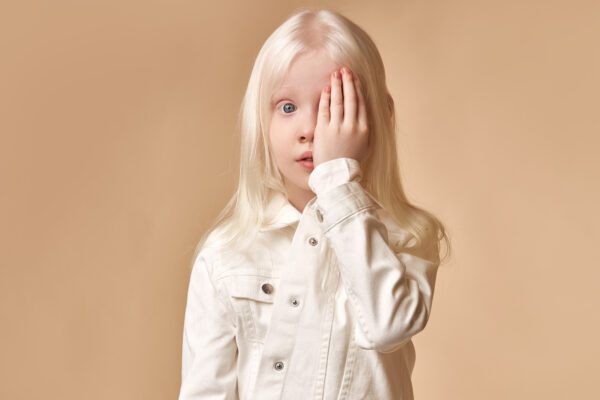 Wat veroorzaakt de spontane oogbewegingen in albinisme?