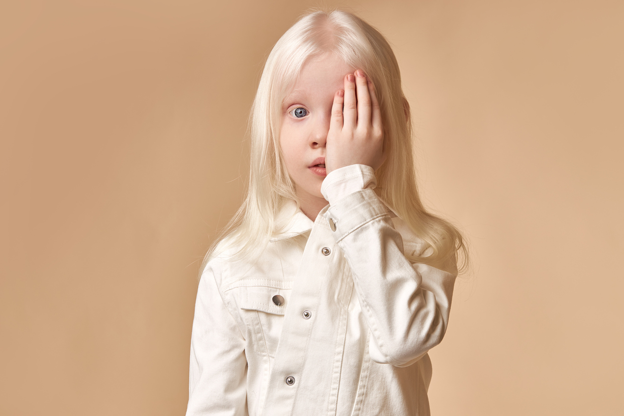 Wat veroorzaakt de spontane oogbewegingen in albinisme?