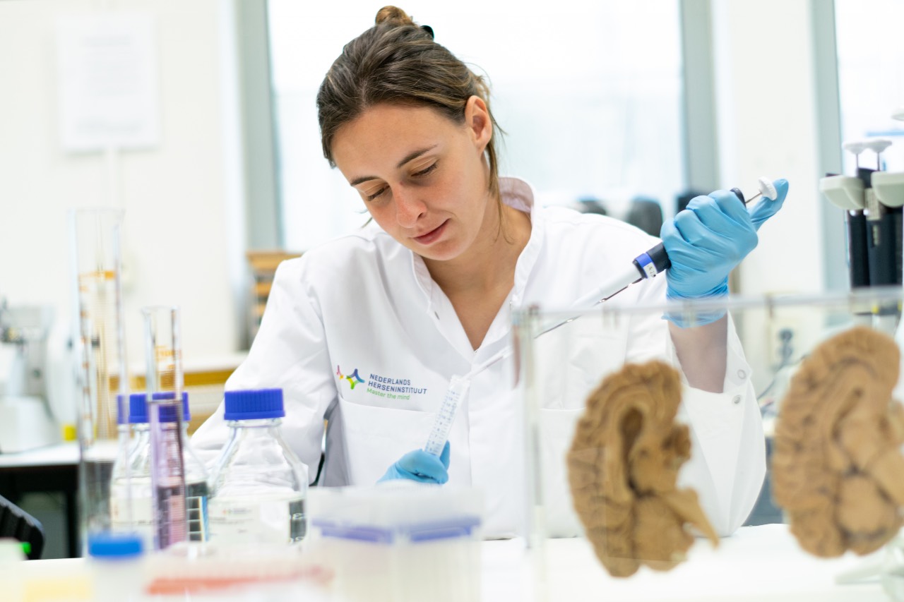 Hersenbank ontvangt 5000e brein voor hersenonderzoek