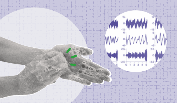 Neurale biomarkers ontdekt voor obsessieve-compulsieve stoornis
