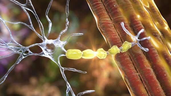 Eerste stap richting gentherapie voor multiple sclerose